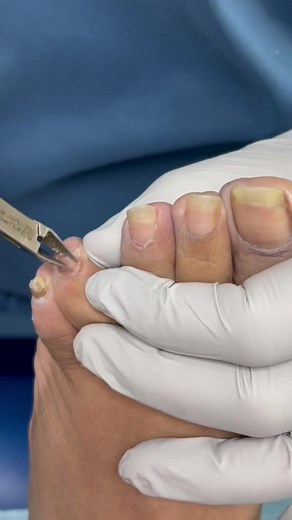 Step-by-Step Quiropodia for Clinical Pedicure and Foot Health