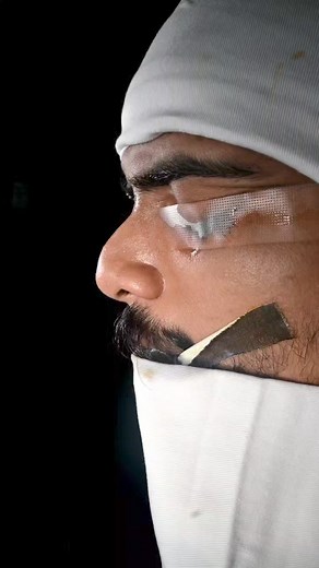 1K views · 22 reactions | Addressing axis deviation through strategic...