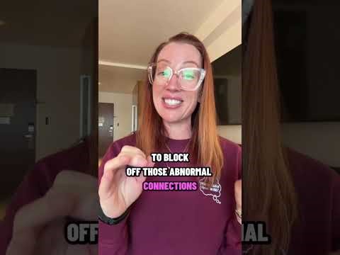 Case Study 199: Arteriovenous Malformations (AVMs)