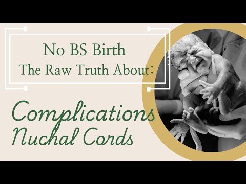 Cord Around Baby’s Neck During Birth: Should You Be Worried