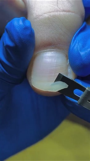 Pedicure Knife | Nail Salon