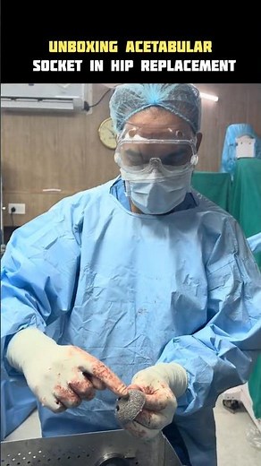 Unboxing the Acetabular Socket in Hip Replacement 🦴 | How Hip Replacement Really Works