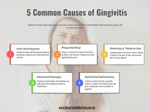5 Common Causes of Gingivitis - SlideServe