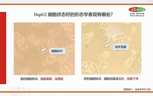 HepG2细胞培养攻略
