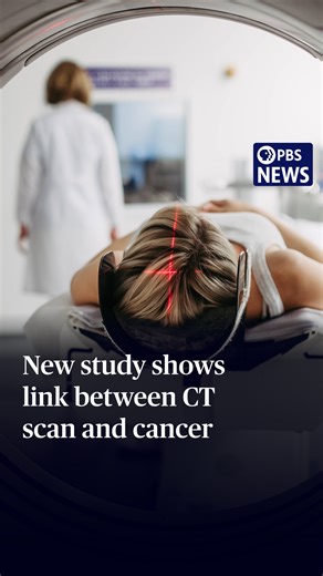 189K views · 778 reactions | CT (computed tomography) scans are...