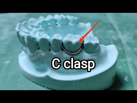 Fabrication of C clasp