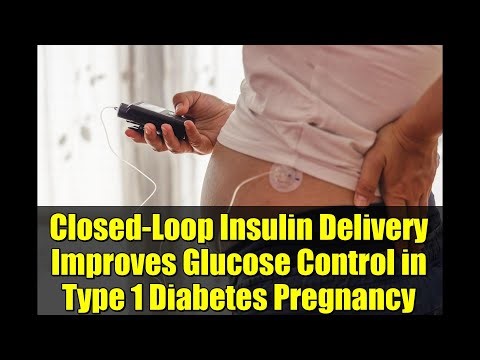 Closed-Loop Insulin Delivery Improves Glucose Control in Type 1 Diabetes Pregnancy