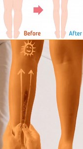 Calf muscles massage techniques #calfmassage #calfmuscles #calfpain #legmassage #종아리마사지 #종아리보톡스 | 다이어트
