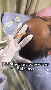Platelets rich plasma therapy (PRP) injection  for hair loss like male pattern baldness, female pattern baldness or telogen effluvium. | Nepal Skin Care Centre | Facebook