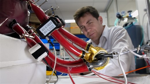 Real-life Iron Man: World's first heart made from Titanium keeps a man alive