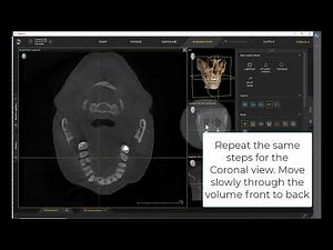 Imaging Training Session 27: Sidexis 4 – MPR Layout