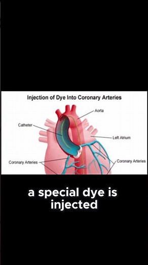 5 Things You Need to Know About Cardiac Catheterization | #cardiacwellness