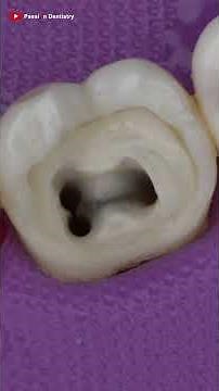 Mind Blowing Teeth Restoration Dentist #asmrsounds #satisfyingvideo