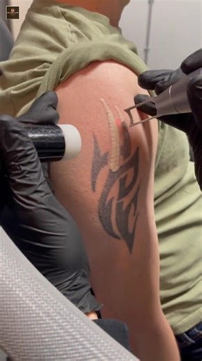 The Power of Tattoo Remover.