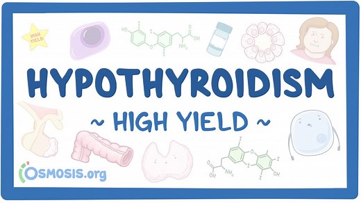 Hypothyroidism: Pathology review: Video, Causes, & Meaning | Osmosis