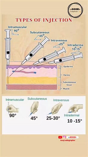 Anuj radiographer | Different Types Of Injections !! **The main types of medical injections, categorized by where the needle is inserted, are intravenous... | Instagram