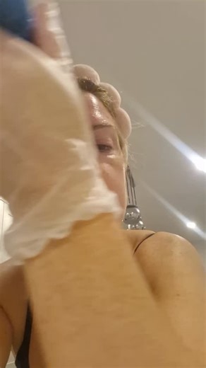 Microneedling works by creating tiny, controlled micro-channels in the skin. This stimulates your body’s natural healing response and boosts collagen and elastin production helping your skin rebuild itself from within. 💛 Microneedling provides a multitude of benefits 💦Promotes collagen production 🙌🏼Softens fine lines & wrinkles 🩸Increases blood flow 🔄Promotes cell turnover 💥Improves complexion 👱🏻 Improves skin texture & tone 💆‍♀️Reduces acne scarring and minimises pores 🫗Enhances prod