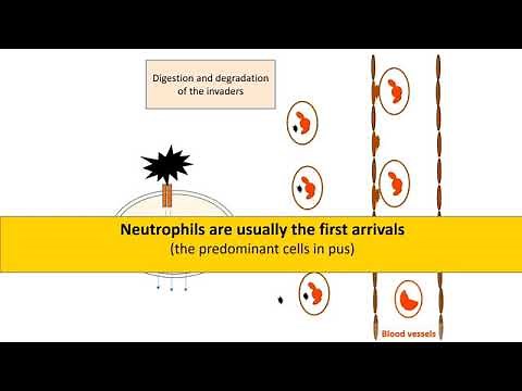 Pus, Neutrophils and Antigen Presenting Cells APCs
