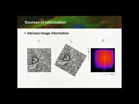 Basics of Image Processing: Image Registration