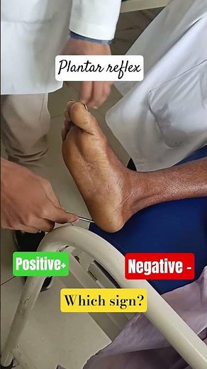 Plantar reflex