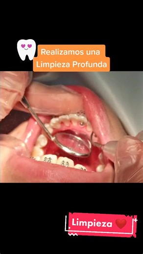 #Dentimax #DentimaxCajica #Odonto #Tooth #LimpiezaDental #dentist