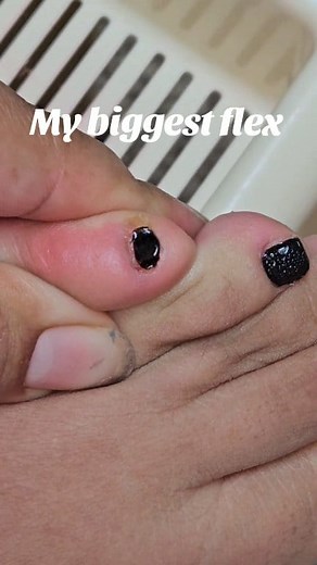 549K views · 1.1K reactions | Asi dejo de el hongo mi uña de chiquita | Marisol Beauty Tutorials | Facebook