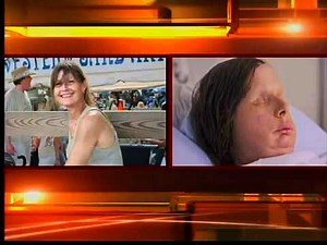 Charla Nash face revealed