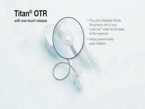 Titan Penile Implant Animation