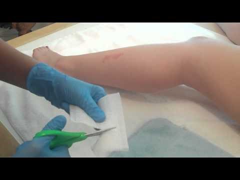 How To Bandage A Wound