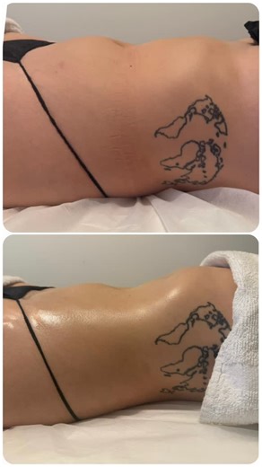 Pre & Post Operative | Lymphatic Drainage | Body Contouring on Instagram: "Bloat? We don’t know her. Not when The LymphAddict Flow steps in like the main character she is — sculpting, de-puffing and clearing out everything your body’s been holding onto 🦠☣️🗑️ What does lymphatic drainage do? • Reduces water retention • Clears inflammation • Speeds up digestion • Defines the waist + abdomen • Leaves you lighter + more aligned Benefits clients feel immediately: • Less puffiness • More defined wai