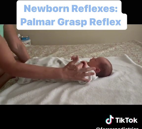 Palmar Grasp Reflex Onset: 10 weeks gestation Disappears: 4-6 months Testing: Supine, place finger in infant’s hand from ulnar to palmar surface Response: Infant’s fingers flex around finger Interferes with ability to grasp/release objects voluntarily, weight bearing on open hand for propping, crawling, and protective responses if it does not disappear by 4-6 months #fyp #fypシ #education #mtfprograms #firsttimemom #newborn #reflexes #expectingmom #primitivereflexes #newparents