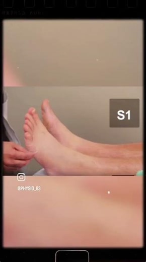 Low back pain , objective examination #reels #trending #viral #viralvideo #viralreels #viralshorts