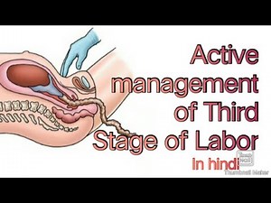 AMTSL/ACTIVE MANAGEMENT OF THIRD STAGE OF LABOR/THIRD STAGE OF LABOR/OBSTETRICS AND GYNECOLOGY