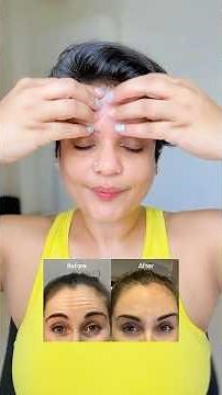 Fix forehead wrinkles at home | Face yoga