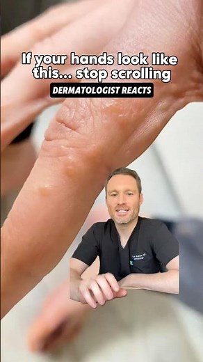 Tiny, itchy bumps on your hands? 😵‍💫 Watch this!