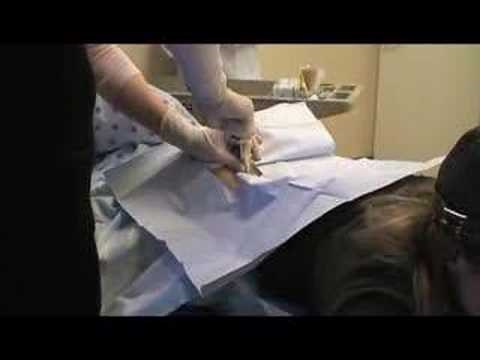 Bone Marrow Biopsy 2