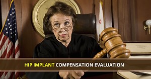 Over a Billion Dollars has already been awarded through judgments & settlements for patients with Defective Hip Implants. Anyone who experienced complications or needed corrective surgery may be eligible to financial compensation. Those affected can click below to see if they qualify. | Lawsuit Watch