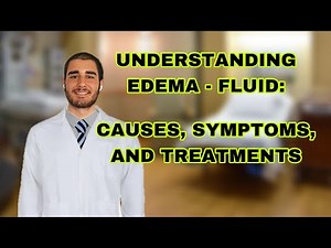 Understanding Edema - Fluid: Causes, Symptoms, and Treatments