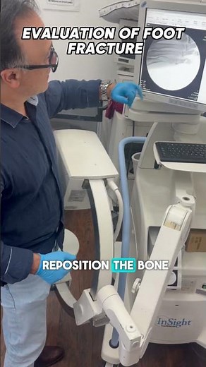 Oblique foot fracture