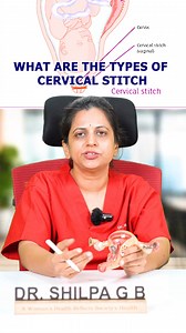 In the realm of obstetrics, cervical stitches play a crucial role in supporting pregnancies, particularly in cases of cervical incompetence. Let’s explore the different types of cervical stitches: McDonald Cervical Stitch: 👉 This is the simplest and most commonly performed cervical stitch. 👉 It involves placing a stitch around the cervix in a circular manner using a special tape, without cutting open the bladder or accessing the pouch of Douglas. 👉 It provides effective support to the cervix,