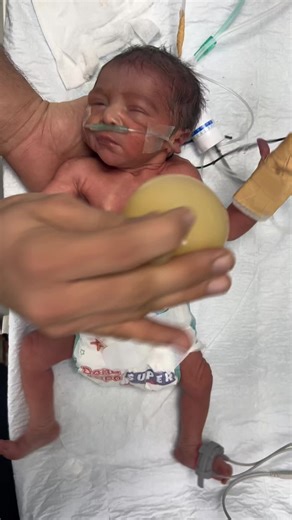 baby not responding no cry 😭#usa🇺🇸 #babycare #preterm | baby