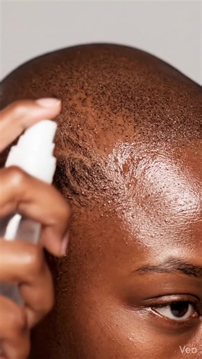 Revitalize Your Locks with Hair Growth Spray