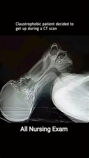 Claustrophobia During CT Scan 😰 | How to Stay Calm & What to Do