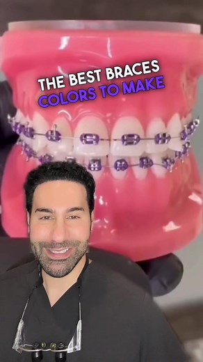 Best Braces Colors for Whiter Teeth