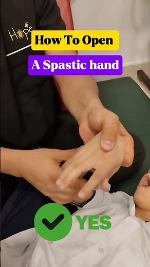 how to open the hand of a spastic CP
