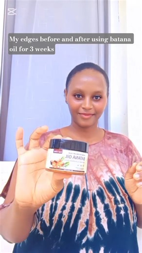How to grow your edges fast#youtubeshorts #haircare#batanaoil #hair#naturalhair#naturalhairproducts