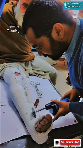 "Plaster Cast Removal: A New Chapter in Healing"