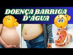 DICAS DE SAÚDE DR MARCELO SANDRIN: DOENÇA DA BARRIGA D'ÁGUA E SUAS CONSEQUÊNCIAS