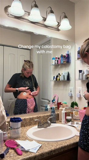 How to Change My Colostomy Bag: Step-by-Step Stoma Care