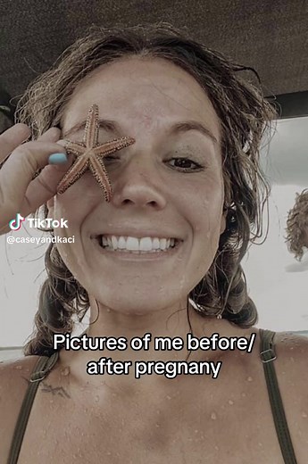 Casey & Kaci Pregnancy Shoot Before Vs After Trend